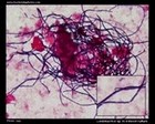 lactobacillus in hemoculture microscopy